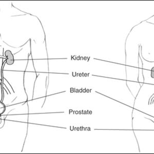 Foul Smelling Urine Photos 