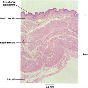 Causes Of Bladder Inflammation Community 