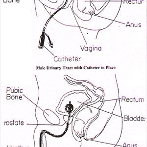 Burning Sensation During Urination Articles - How To Treat UTI At Home - 3 Tips You Can Count On