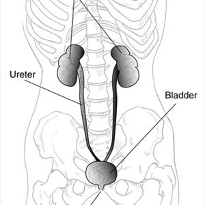 Urinary Tract Infection Symptoms Natural Treatment - Urinary Tract Infection Home Remedy - Cure Uti Naturally