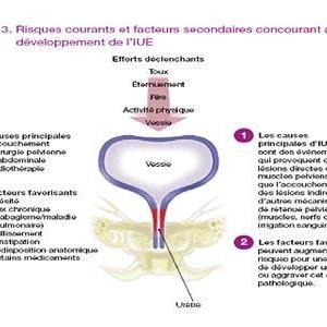 E Coli Uti - Problems During Urination - Needs Attention