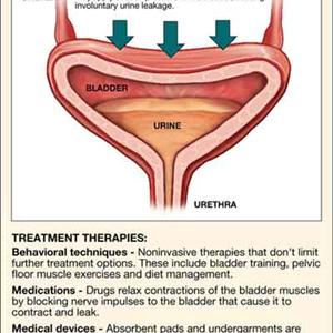 Uti Causes Symptoms Complications - Bladder Infection Treatment 