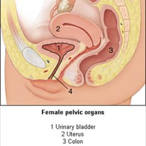 Chronic Urinary Tract Infection - Cranberries And Flaxseed - A Powerful Combination For Women