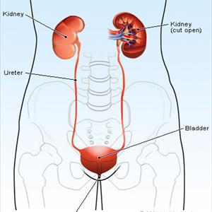 Natural Cures Urinary Tract Infections - Antibiotics Or Natural Remedies For Treating A UTI 