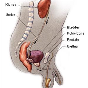 Bladder Inflammation Videos - About Urinary Tract Infection - Prevention And Treatments
